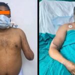 Man Lost Both Hands in Train Accident Gets New Ones From Brain Dead Donor and Paints Again Screenshot_20260411-130536