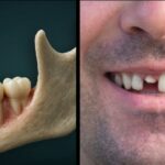 Good News: Japan Has Started Testing World-First Tooth Regrowing Drug On Humans (Full Details) Screenshot_20260509-205611